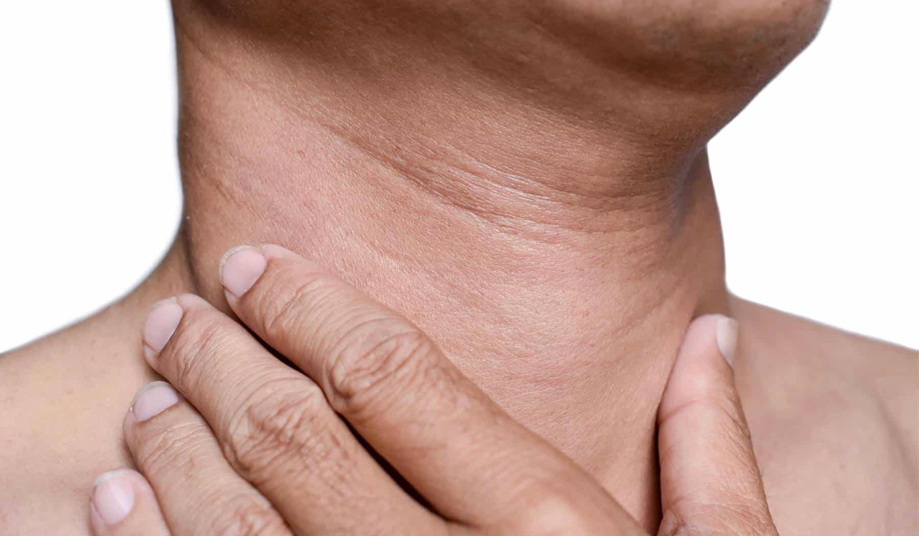 closeup of neck wrinkles on a woman